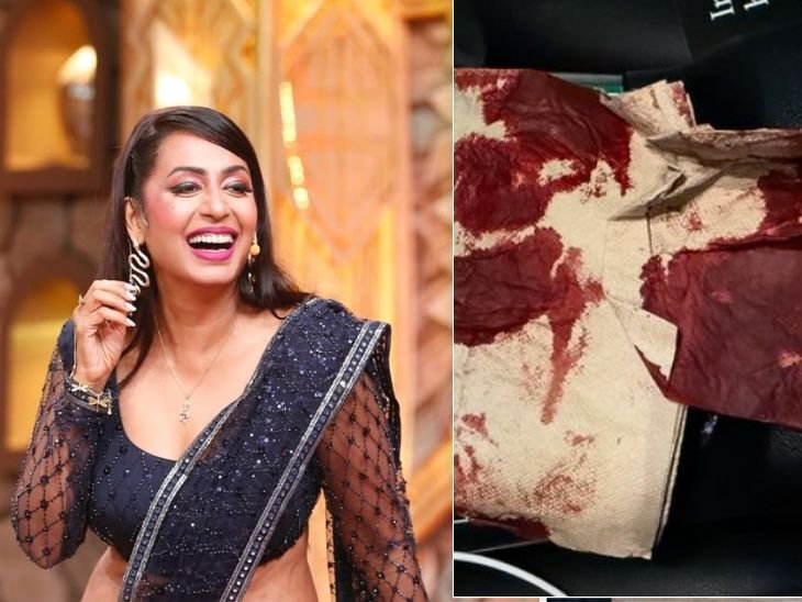 Kashmira Shah met with a road accident, share picture after accident and said Thank u god for saving me. Such a freak accident. | कश्मीरा शाह का हुआ बड़ा रोड एक्सीडेंट: खून से सने नैपकिन दिखाकर बोलीं- कुछ बड़ा होने वाला था, छोटे में निकल गया, कृष्णा अभिषेक ने किया रिएक्ट