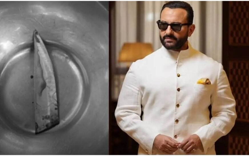 Photo of part of knife removed from actor’s body released – India TV